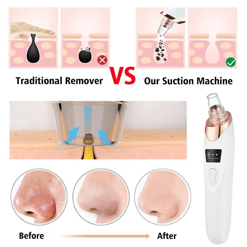 Blackhead Remover And Multifunctional Derma Suction Machine